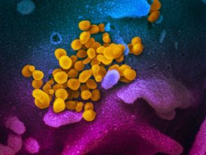 novel coronavirus sars cov 2 49531042877 o 7cf68b8a7cd48d5a38e9333dcb684704cdb0ee86 s800 c85